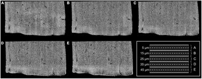 Quantitative optical coherence microscopy of neuron morphology in human entorhinal cortex